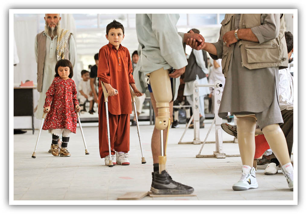 زندگی پدیا/ سرزمین باران پاهای‌مصنوعی