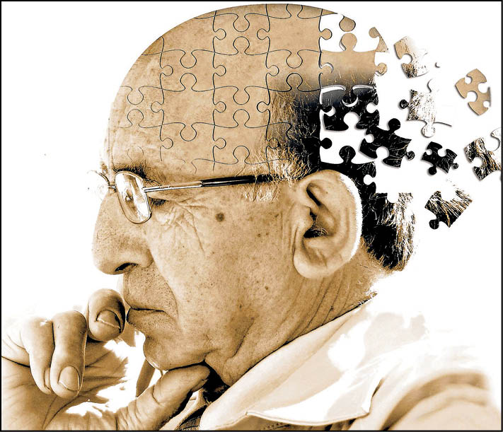 طغیان جهانی آلزایمر