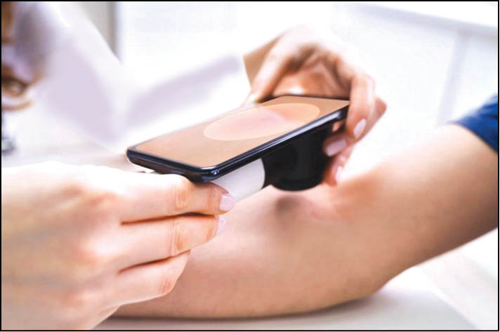 تشخیص زودهنگام سرطان پوست با هوش مصنوعی