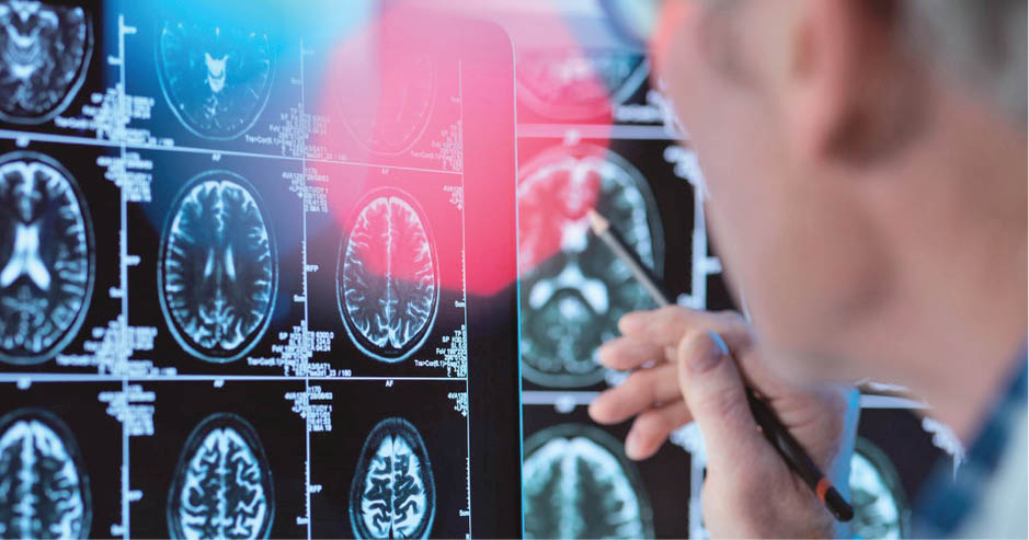 زوال فراموشی؛ آغاز آزمایش انسانی واکسن آلزایمر