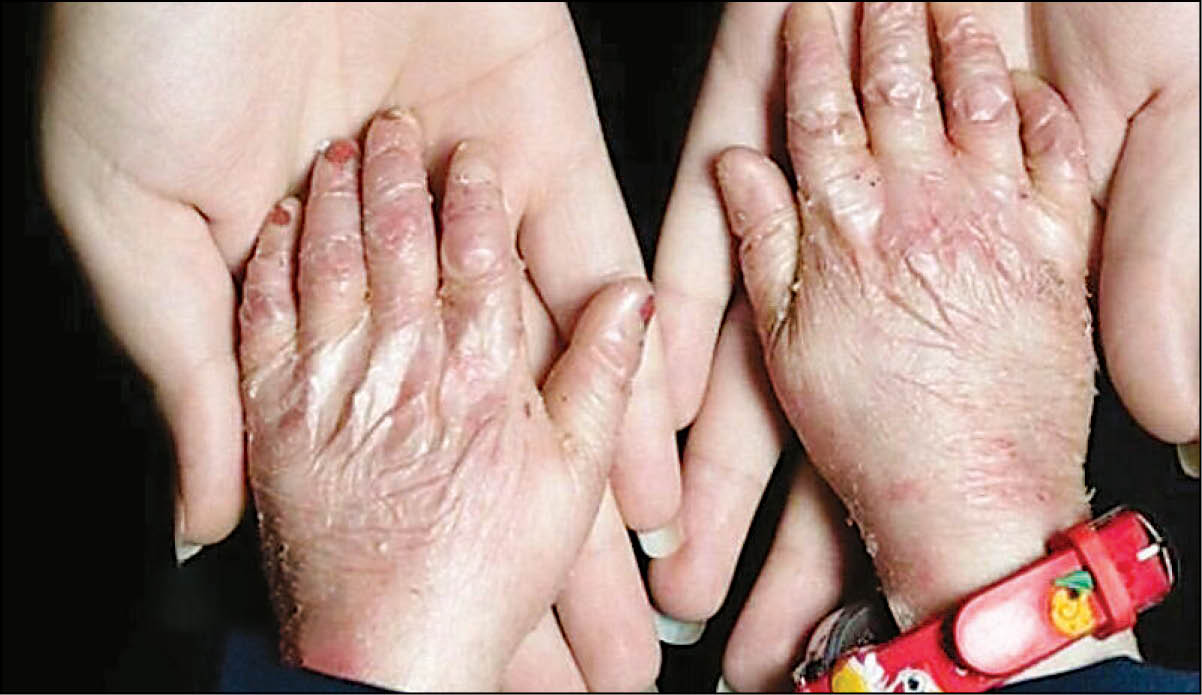 مدیرعامل خانه‌ «ای‌بی» از مشکلات درمانی این بیماران می‌گوید