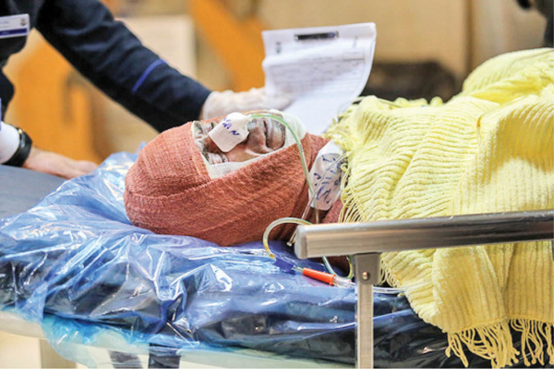 سالانه 30هزار نفر دچار سوختگی می‌شوند