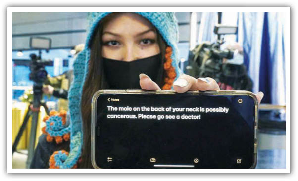 تشخیص خال سرطانی در استادیوم