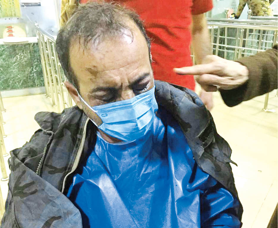 روایت تازه از اسیدپاشی شاهین‌شهر