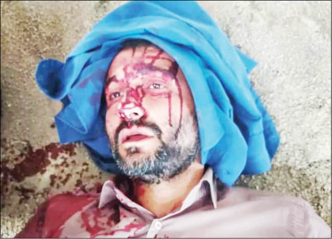 جراحت با قمه نتیجه مبارزه با فساد