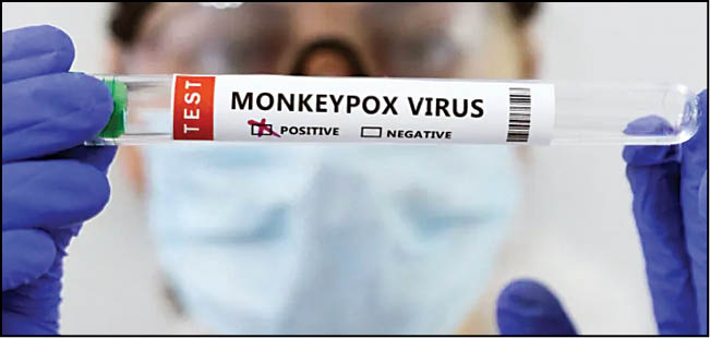 راه‌های فرار از آبله میمونی