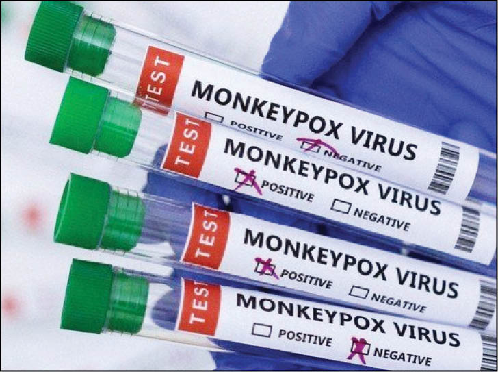 هشدار جهانی برای کنترل آبله میمونی