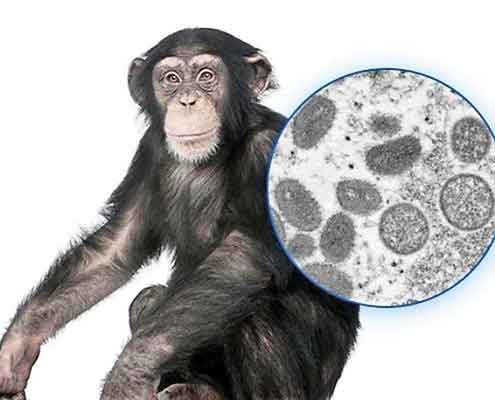 ابتلای همزمان به کرونا و آبله