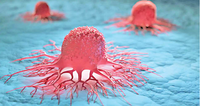 کشف پروتئینی که در متاستاز سرطان نقش دارد