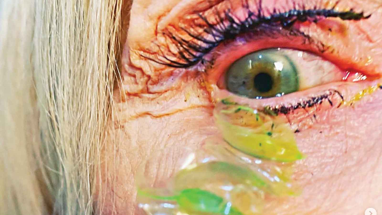 چشم یا انبار لنز؟