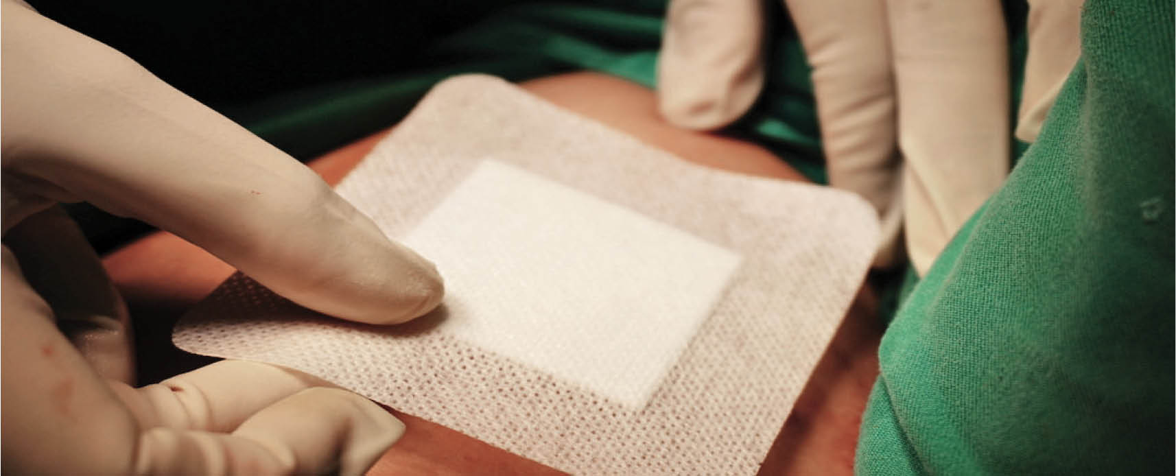 زخم‌پوش ایرانی برای بیماران پروانه‌ای