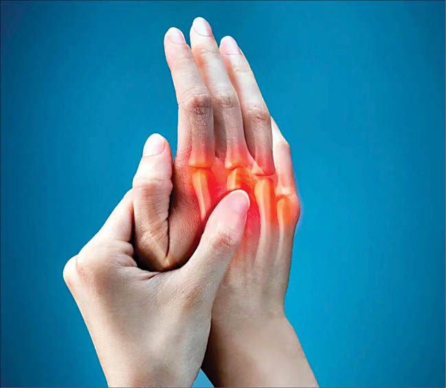 شناسایی باکتری ناشناخته‌ای که باعث التهاب مفاصل می‌شود