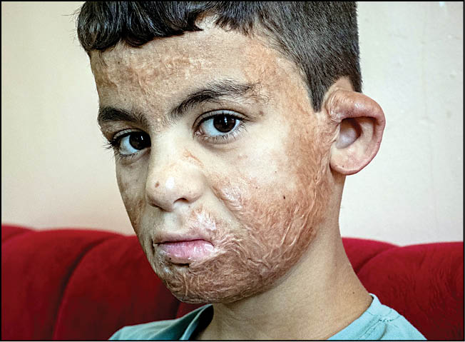 آینده سوخته؛ روایت قربانیان ائتلاف غرب در عراق