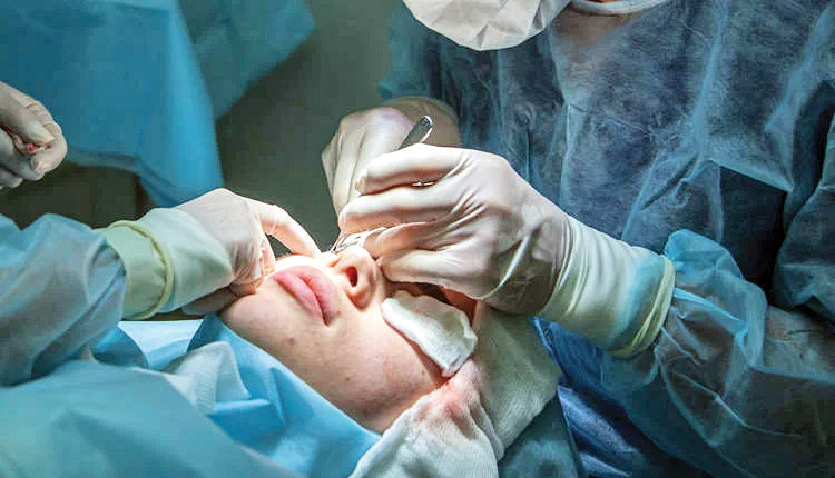 جراحی پلاستیک دختر 9ساله