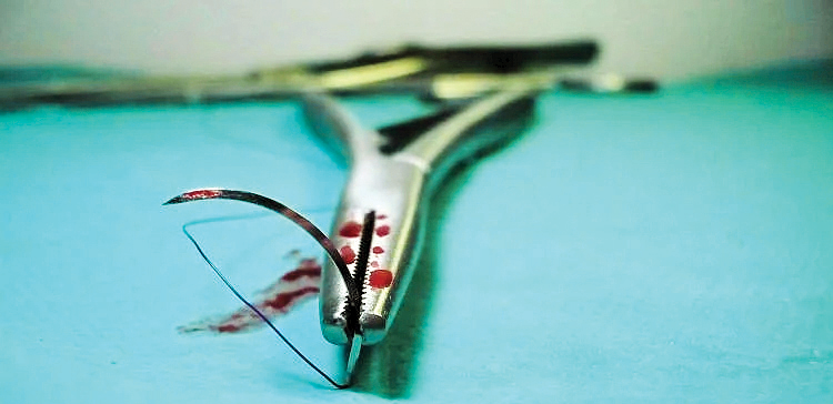 11سال زندگی با سوزن!