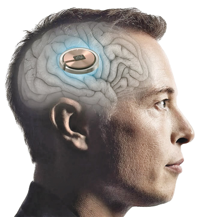 مجوز رسمی پیوند تراشه به مغز انسان