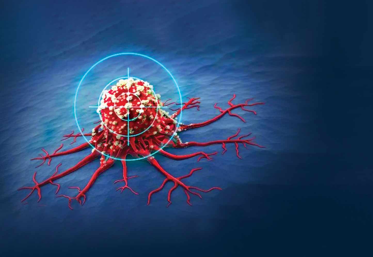 خیز ایران برای درمان سرطان