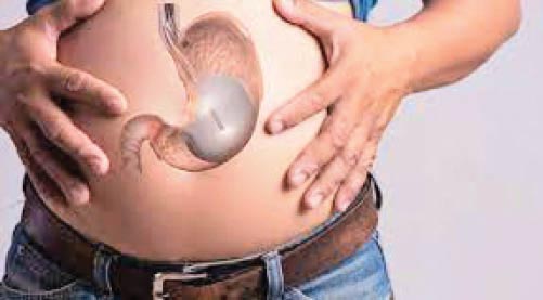 بوتاکس معده چه خطراتی برای لاغری دارد