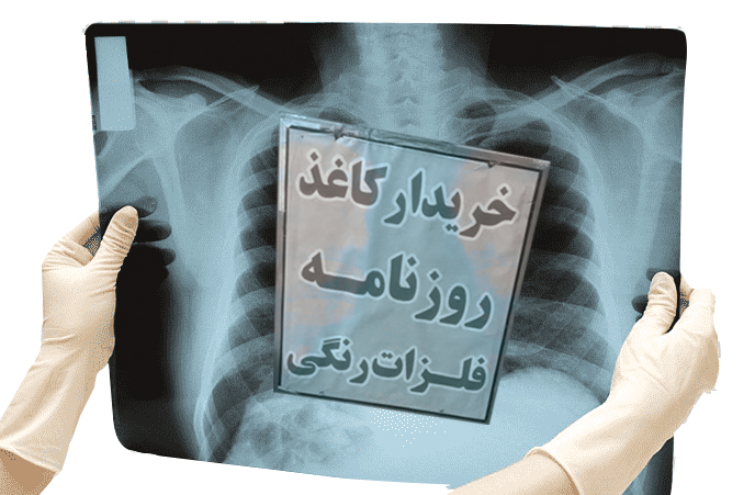 پشت صحنه خرید و فروش عکس‌های رادیولوژی
