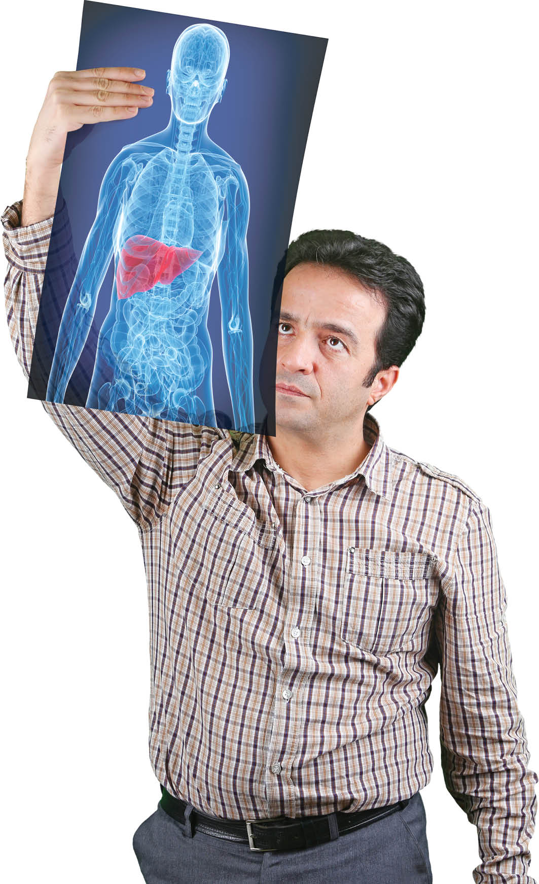 یک‌سوم ایرانی‌ها کبد چرب دارند