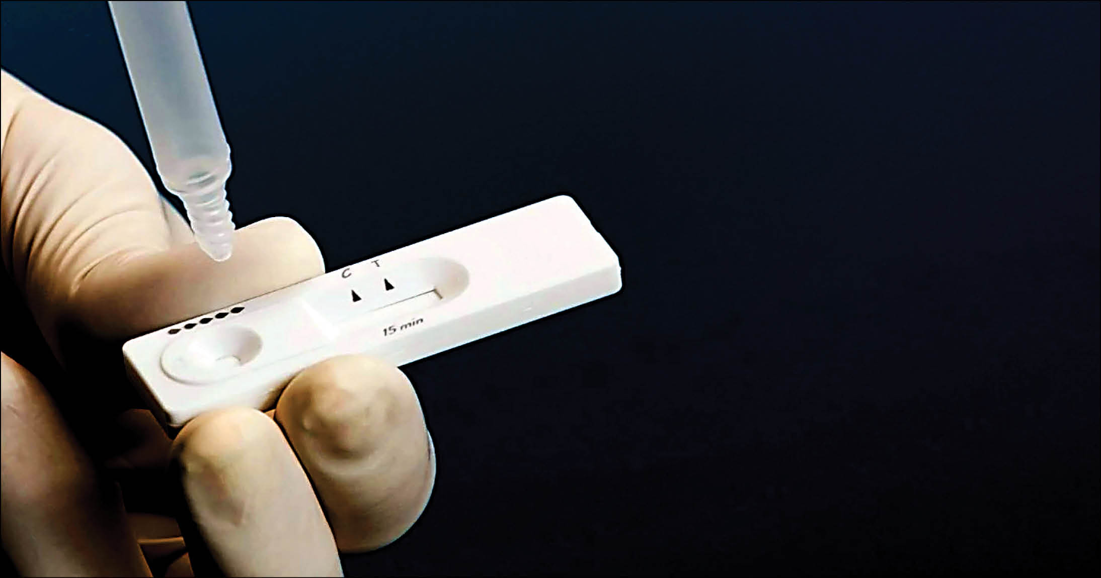 آزمایش تشخیص تب دنگی رایگان می‌شود