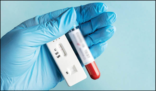 کیت تشخیص سریع HIV بومی‌سازی‌ می‌شود