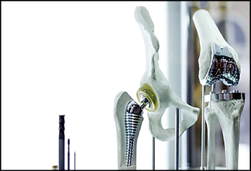 ایمپلنت‌ ستون فقرات کودکان ایران‌ساخت