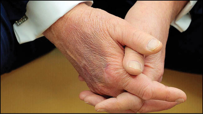 بیماری‌ رئیس‌جمهور آمریکا چیست؟