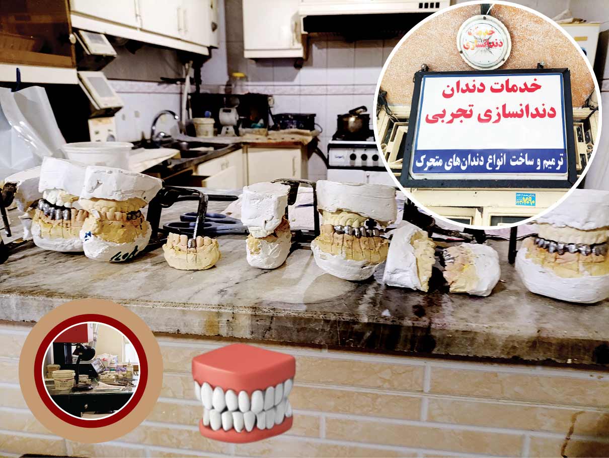 دندان مصنوعی زیر قیمت بازار