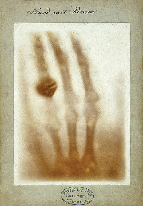 اولین عکس رادیولوژی تاریخ